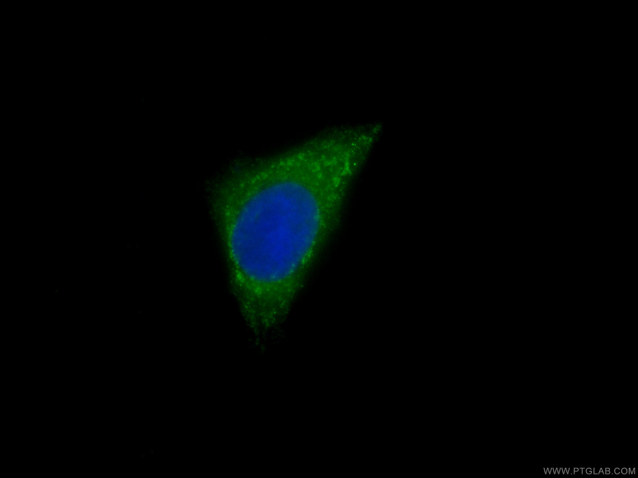 Immunofluorescence (IF) / fluorescent staining of MCF-7 cells using CoraLite® Plus 488-conjugated CAPZA1 Monoclonal an (CL488-66066)