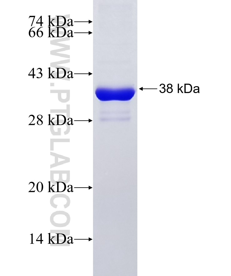 CAPZA1 fusion protein Ag18841 SDS-PAGE