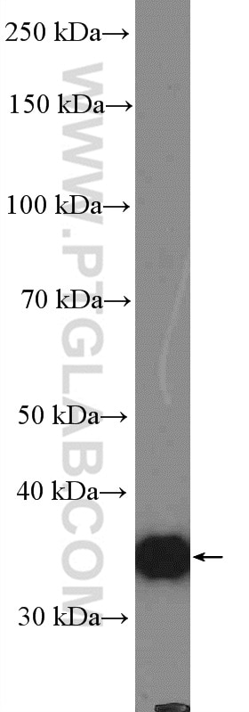 WB analysis of mouse brain using 15948-1-AP