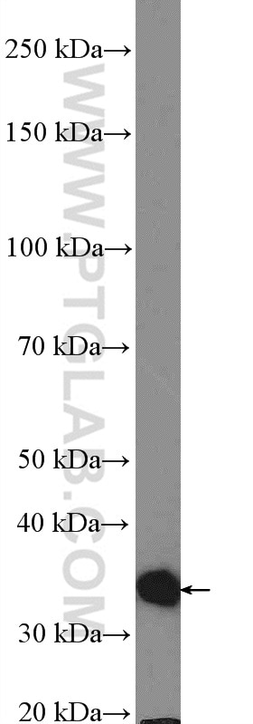 Western Blot (WB) analysis of mouse heart tissue using CAPZA2 Polyclonal antibody (15948-1-AP)