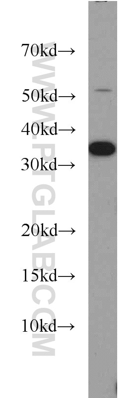 Western Blot (WB) analysis of mouse skeletal muscle tissue using CAPZA2 Polyclonal antibody (15948-1-AP)