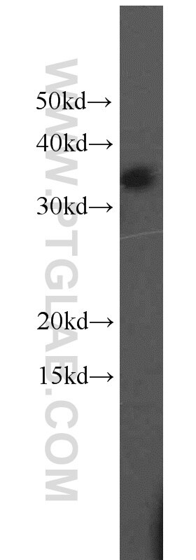 WB analysis of HepG2 using 15948-1-AP