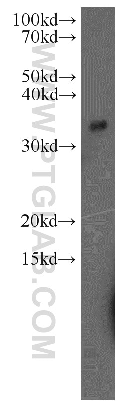 Western Blot (WB) analysis of MCF-7 cells using CAPZA2 Polyclonal antibody (15948-1-AP)