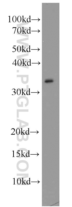 Western Blot (WB) analysis of mouse liver tissue using CAPZA2 Polyclonal antibody (15948-1-AP)