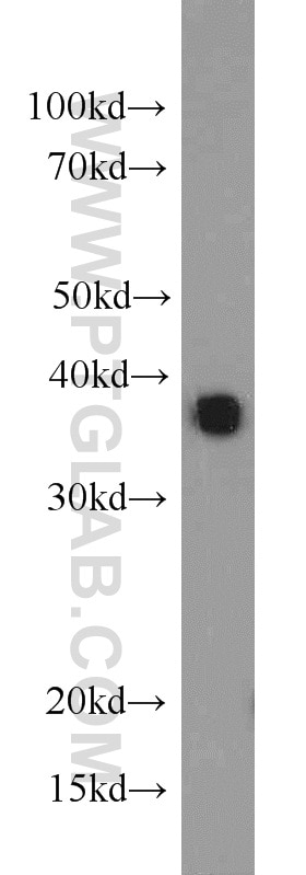 Western Blot (WB) analysis of mouse ovary tissue using CAPZA2 Polyclonal antibody (15948-1-AP)