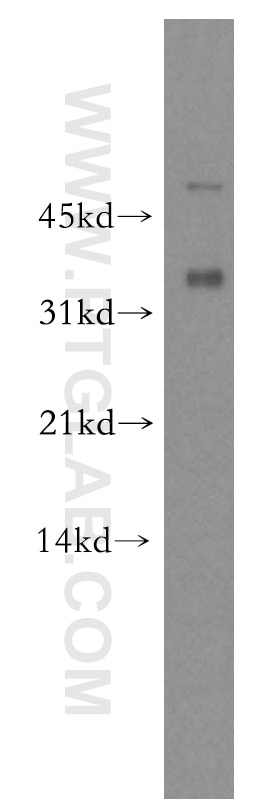 Western Blot (WB) analysis of mouse skeletal muscle tissue using CAPZA2 Polyclonal antibody (15948-1-AP)