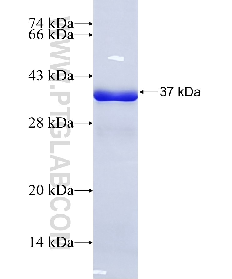 CAPZA2 fusion protein Ag8650 SDS-PAGE