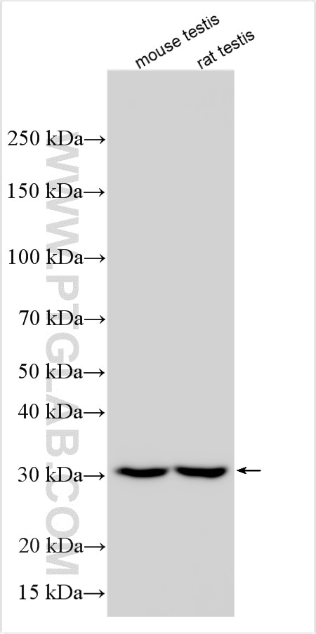 Western Blot (WB) analysis of various lysates using CAPZA3 Polyclonal antibody (17103-1-AP)