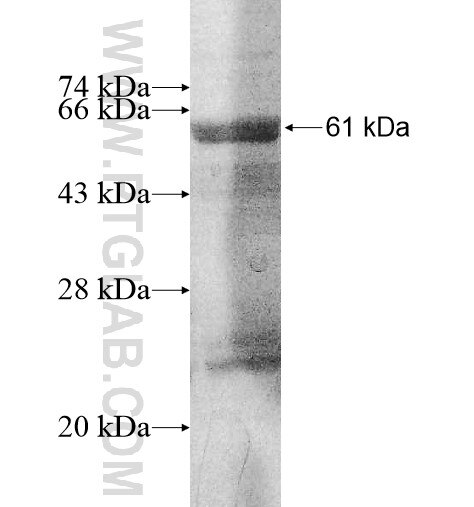 CAPZA3 fusion protein Ag10774 SDS-PAGE