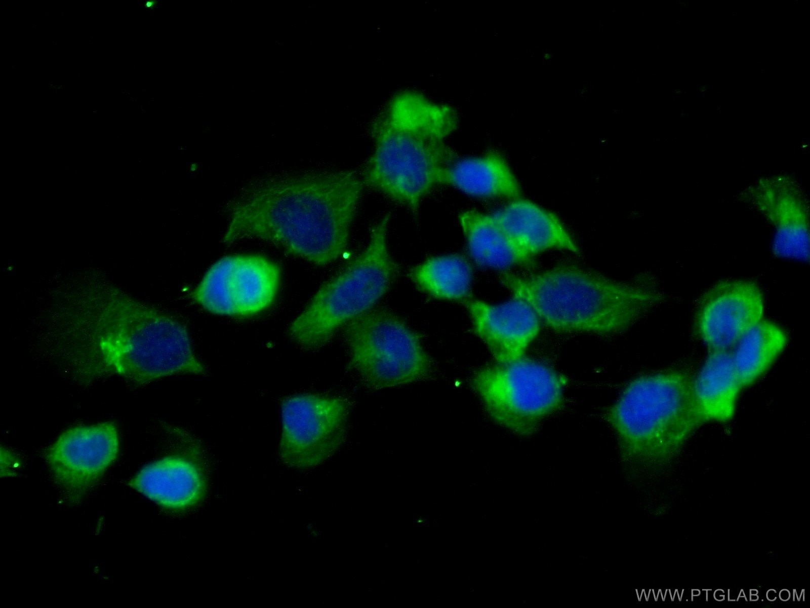 Immunofluorescence (IF) / fluorescent staining of A431 cells using CAPZB Polyclonal antibody (25043-1-AP)