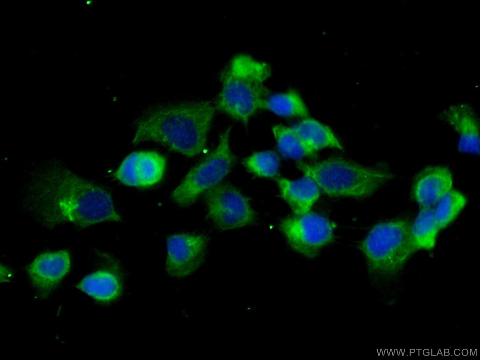 IF Staining of A431 using 25043-1-AP