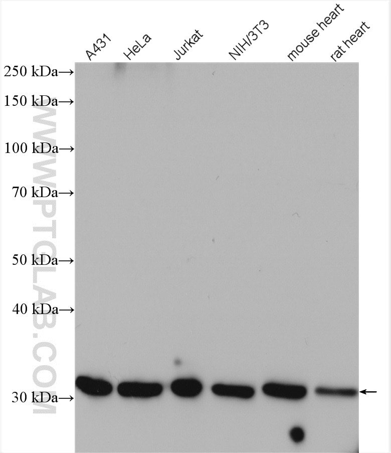 Western Blot (WB) analysis of various lysates using CAPZB Polyclonal antibody (25043-1-AP)