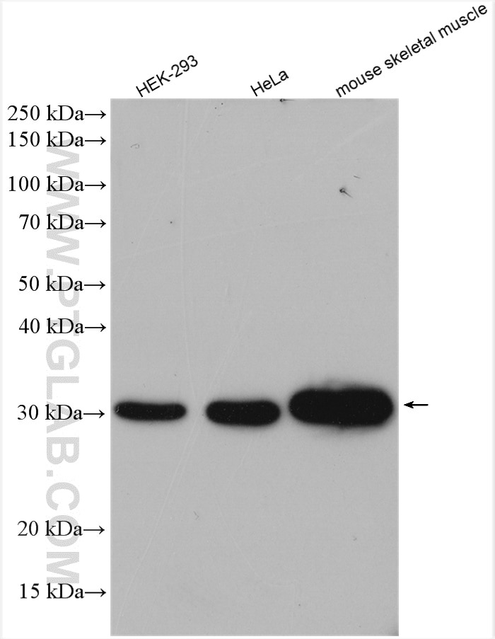 Western Blot (WB) analysis of various lysates using CAPZB Polyclonal antibody (25043-1-AP)