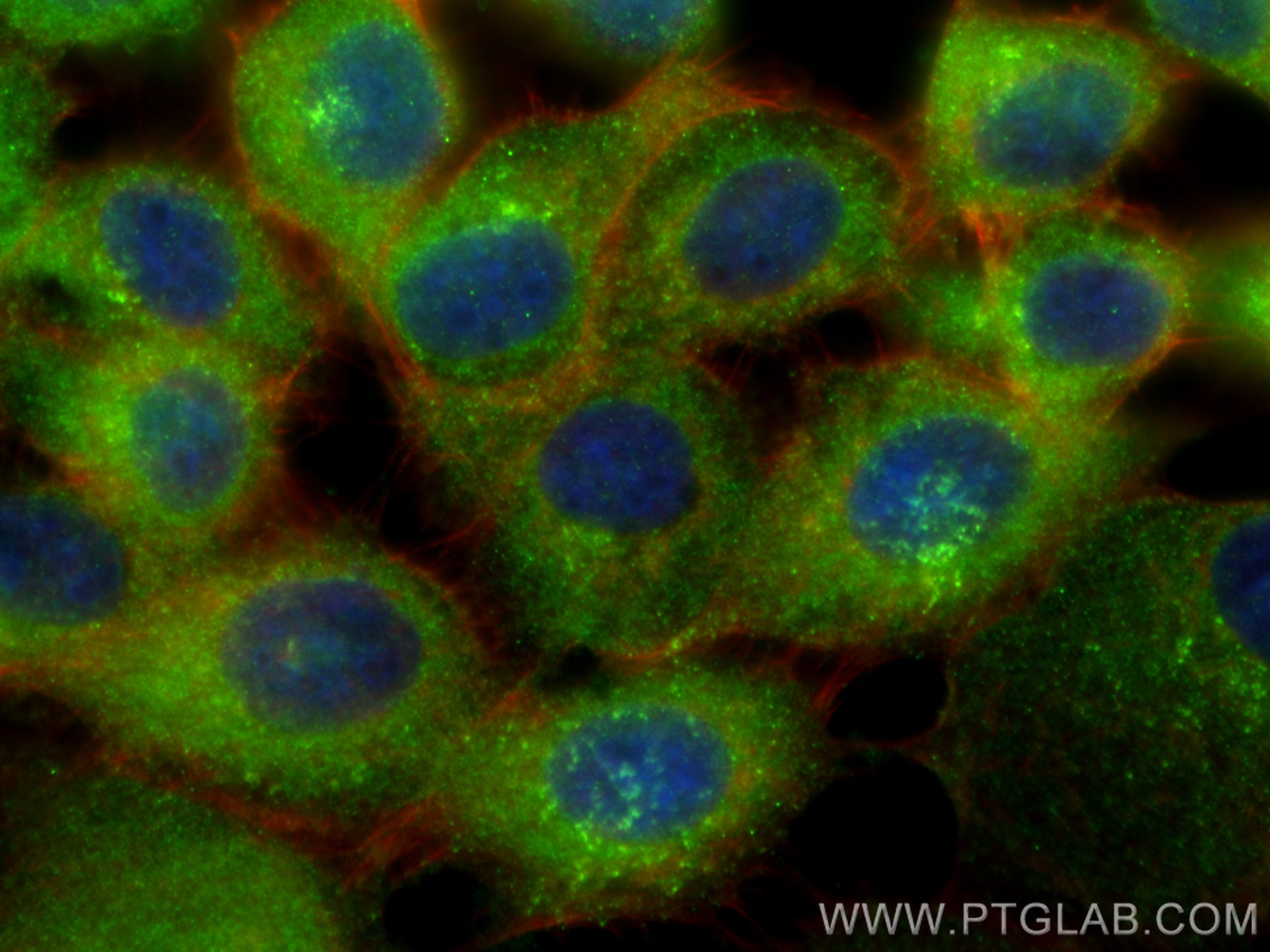 Immunofluorescence (IF) / fluorescent staining of A431 cells using CAPZB Monoclonal antibody (68190-1-Ig)