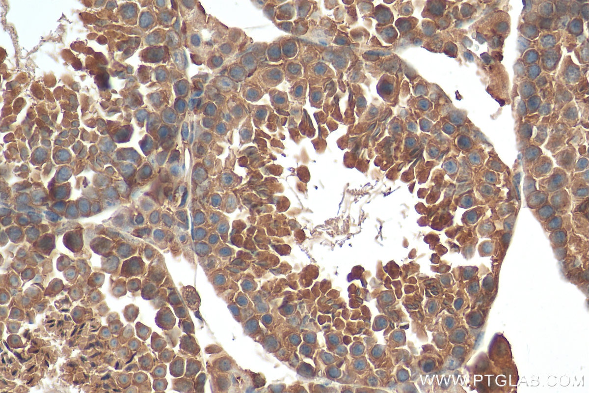 Immunohistochemistry (IHC) staining of mouse testis tissue using CAPZB Monoclonal antibody (68190-1-Ig)