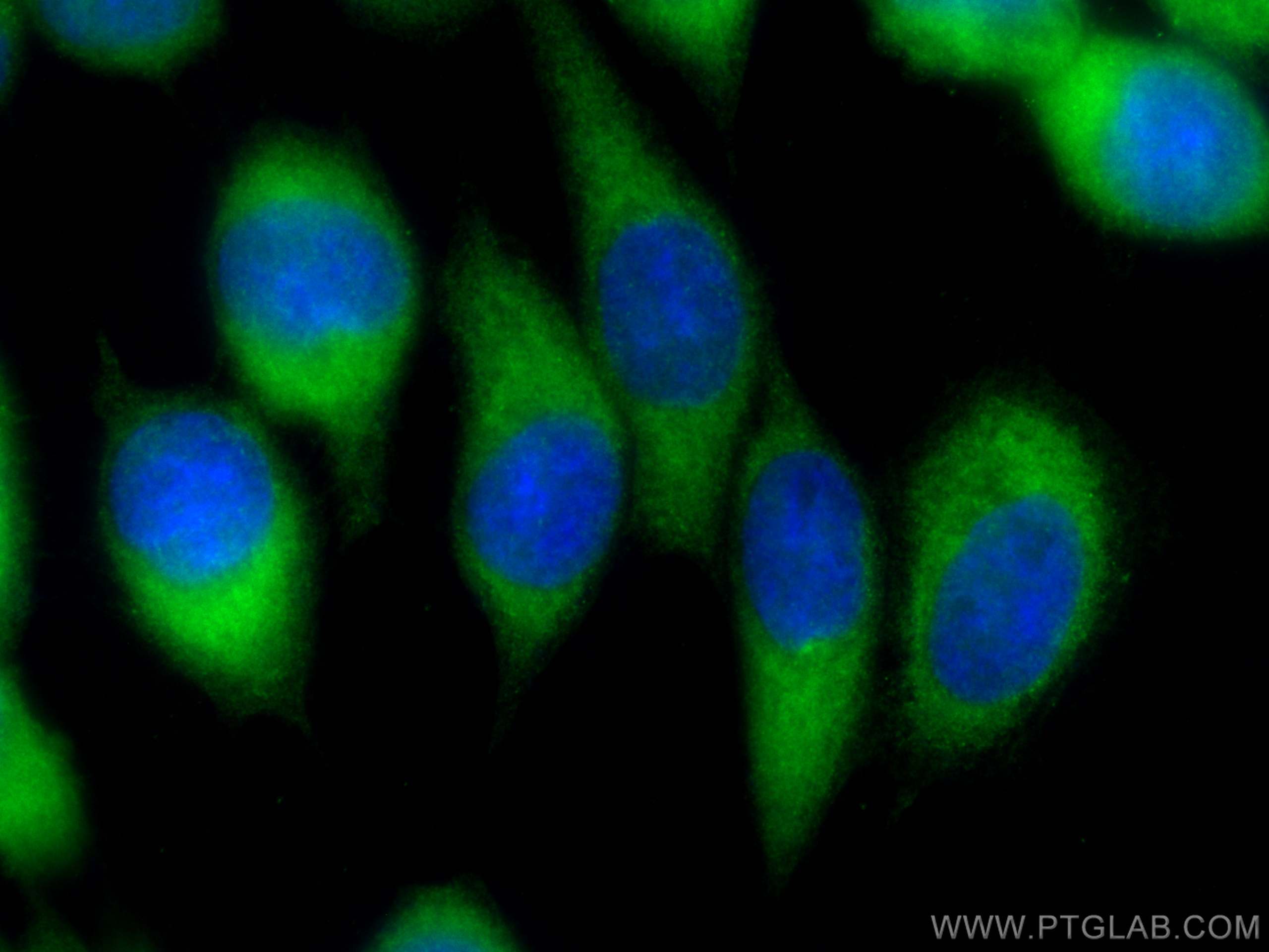 Immunofluorescence (IF) / fluorescent staining of A431 cells using CoraLite® Plus 488-conjugated CAPZB Monoclonal ant (CL488-68190)