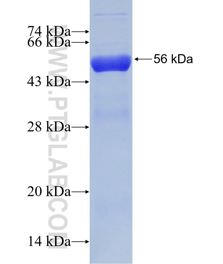 CAPZB fusion protein Ag19327 SDS-PAGE