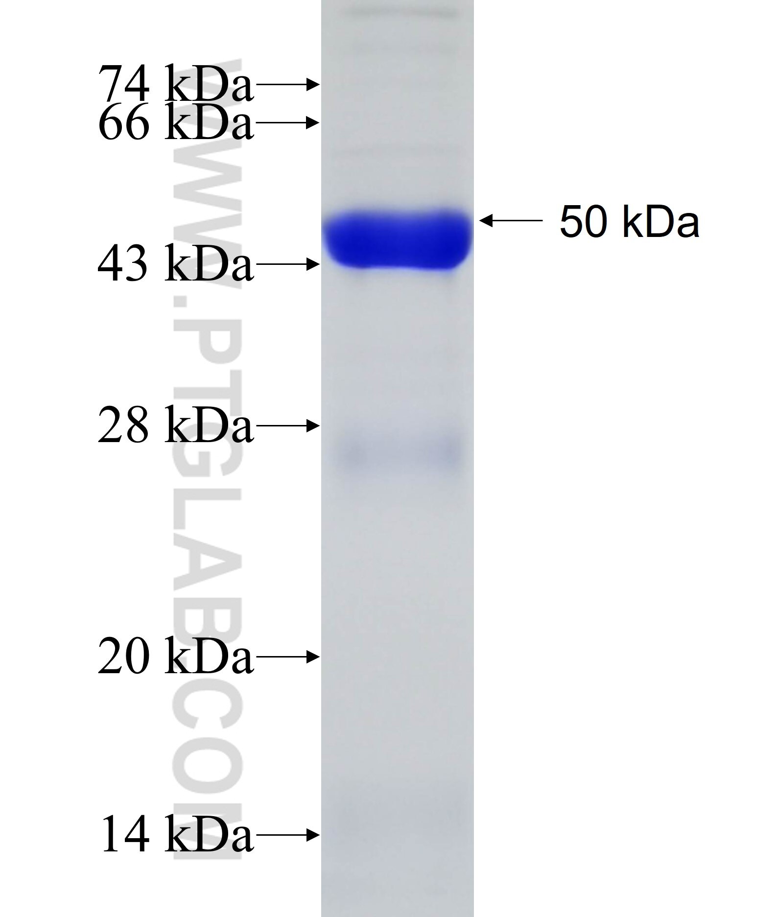 CAPZB fusion protein Ag19327 SDS-PAGE