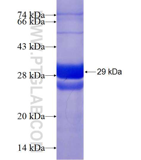 CAPZB fusion protein Ag19373 SDS-PAGE