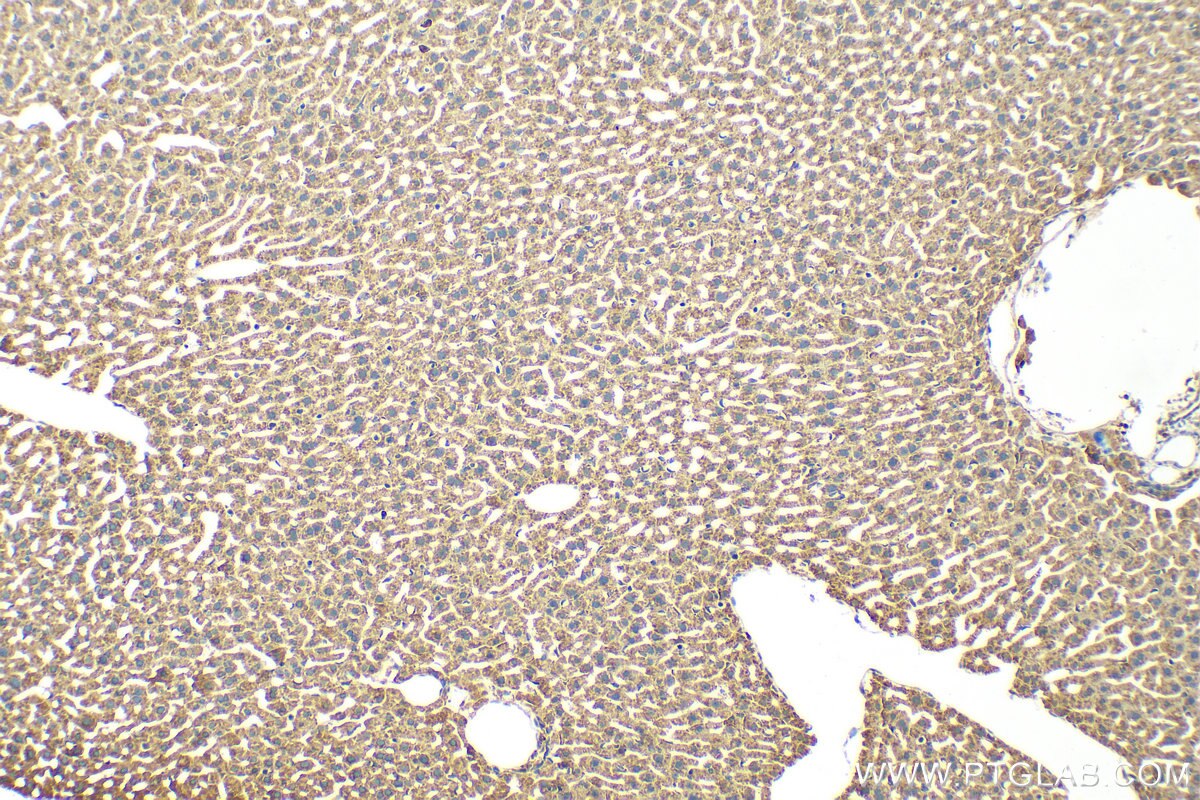 Immunohistochemistry (IHC) staining of mouse liver tissue using CARD10 Polyclonal antibody (24726-1-AP)