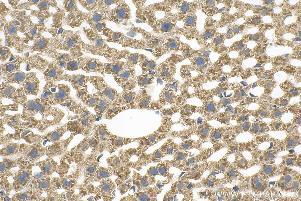 Immunohistochemistry (IHC) staining of mouse liver tissue using CARD10 Polyclonal antibody (24726-1-AP)