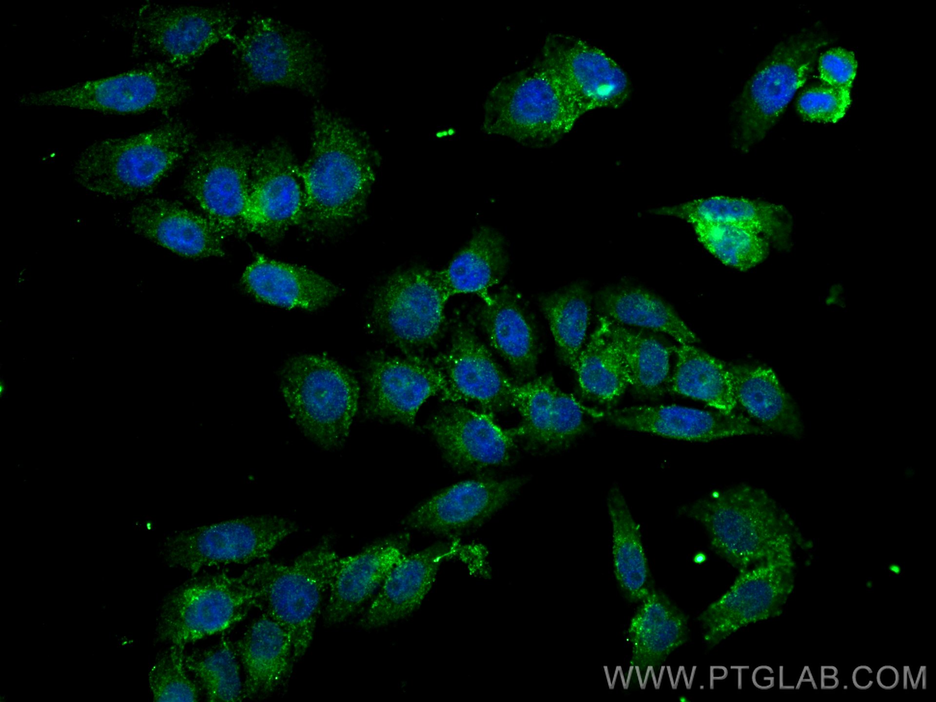Immunofluorescence (IF) / fluorescent staining of L02 cells using CARD11 Polyclonal antibody (21741-1-AP)