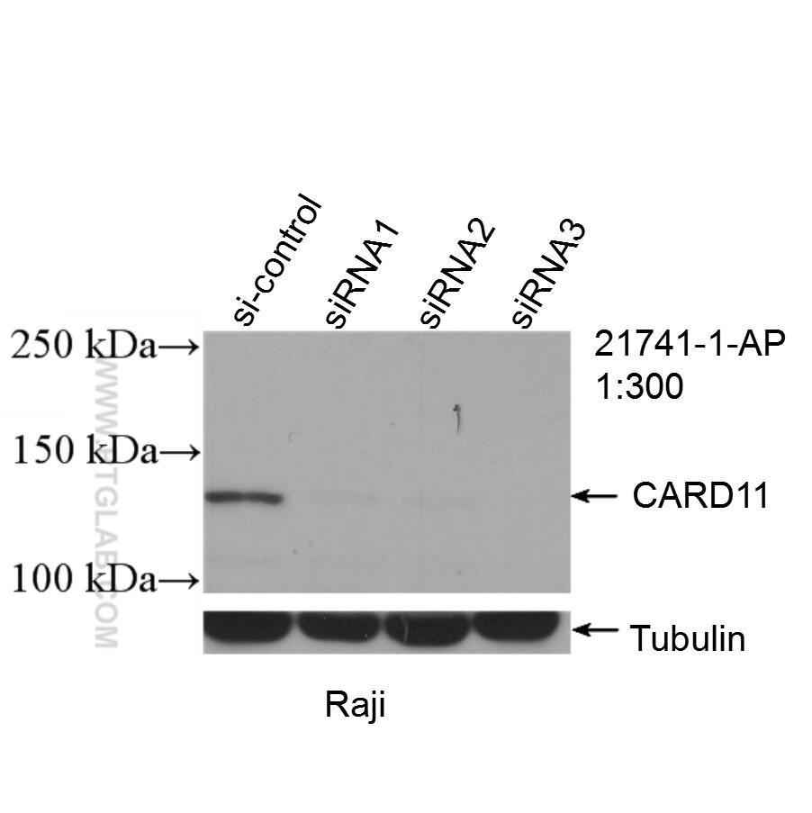 Western Blot (WB) analysis of Raji cells using CARD11 Polyclonal antibody (21741-1-AP)