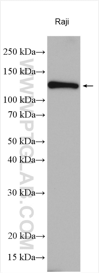 Western Blot (WB) analysis of various lysates using CARD11 Polyclonal antibody (21741-1-AP)