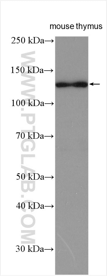 Western Blot (WB) analysis of mouse thymus tissue using CARD11 Polyclonal antibody (21741-1-AP)