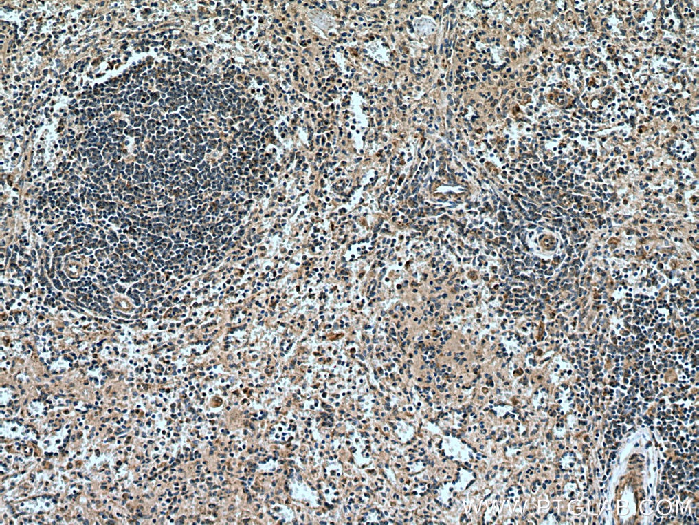 Immunohistochemistry (IHC) staining of human spleen tissue using CARD11 Polyclonal antibody (28483-1-AP)