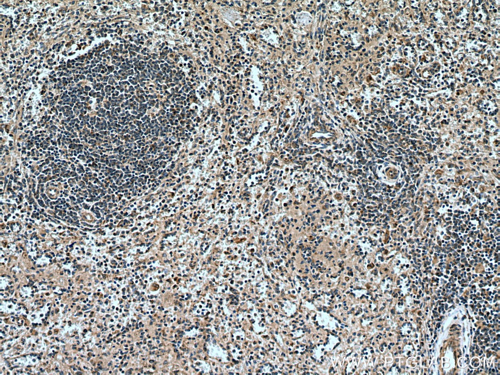 IHC staining of human spleen using 28483-1-AP