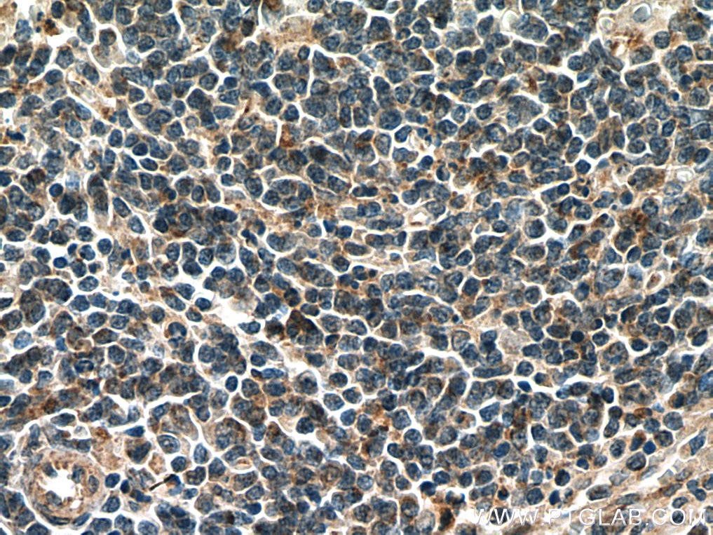 Immunohistochemistry (IHC) staining of human spleen tissue using CARD11 Polyclonal antibody (28483-1-AP)