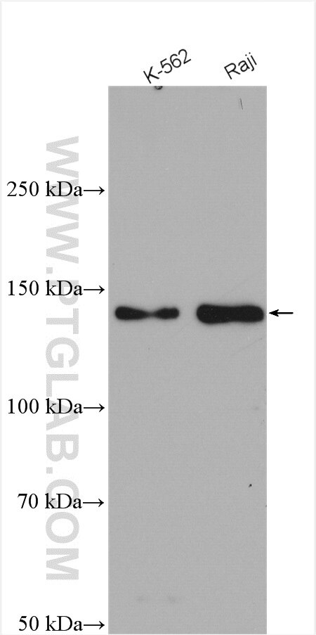 Western Blot (WB) analysis of various lysates using CARD11 Polyclonal antibody (28483-1-AP)