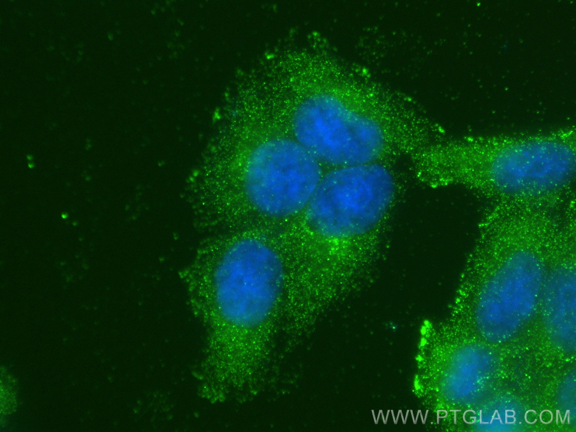 Immunofluorescence (IF) / fluorescent staining of L02 cells using CARD11 Monoclonal antibody (68269-1-Ig)