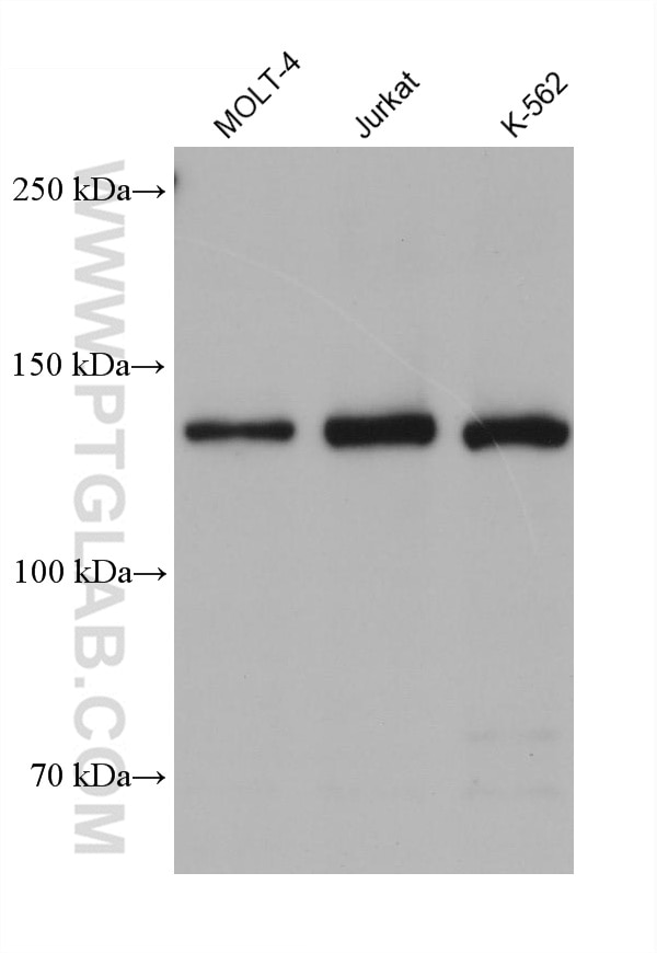 Western Blot (WB) analysis of various lysates using CARD11 Monoclonal antibody (68269-1-Ig)