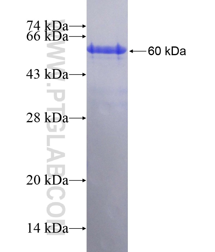 CARD11 fusion protein Ag29355 SDS-PAGE