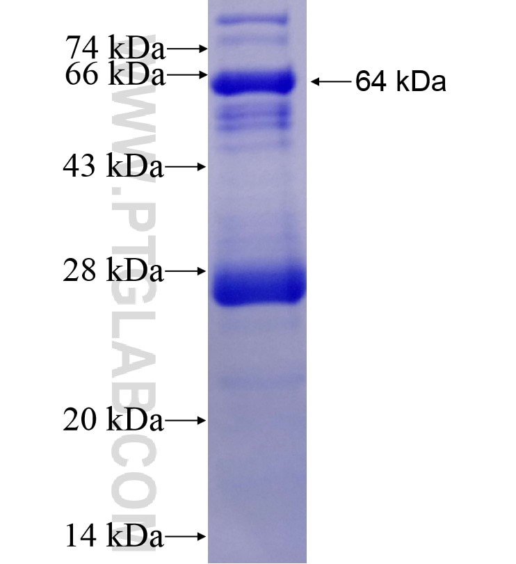CARD11 fusion protein Ag16468 SDS-PAGE