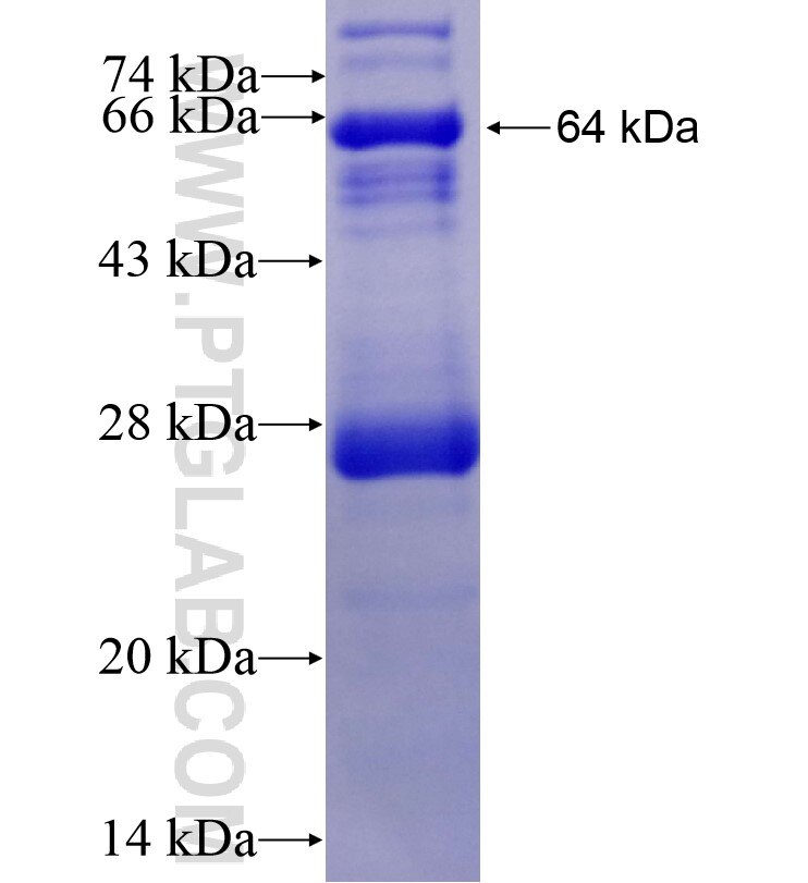 CARD11 fusion protein Ag16468 SDS-PAGE