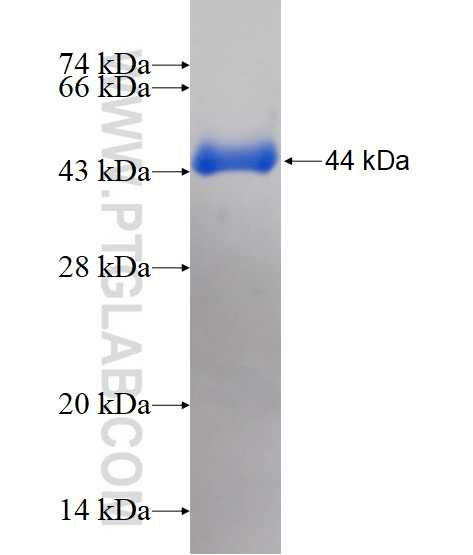 CARD11 fusion protein Ag17397 SDS-PAGE