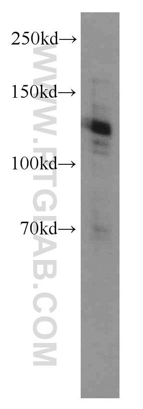 Western Blot (WB) analysis of HeLa cells using CARD14 Polyclonal antibody (10400-1-AP)
