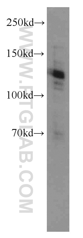 Western Blot (WB) analysis of HeLa cells using CARD14 Polyclonal antibody (10400-1-AP)