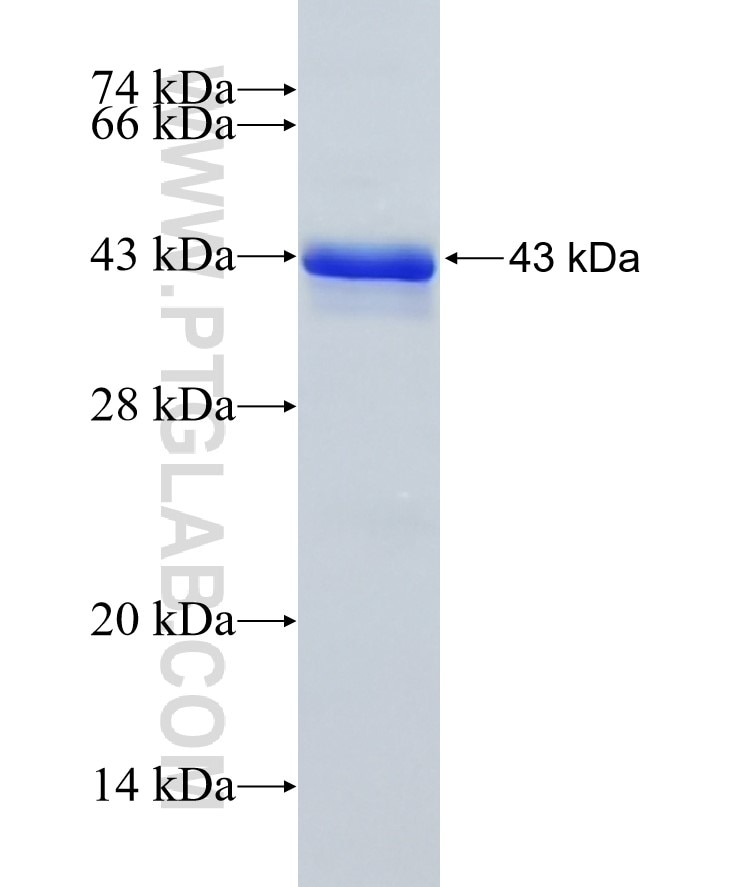 CARD14 fusion protein Ag23700 SDS-PAGE