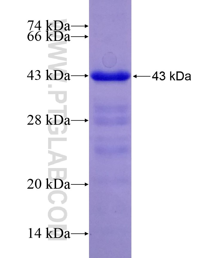 CARD14 fusion protein Ag28988 SDS-PAGE