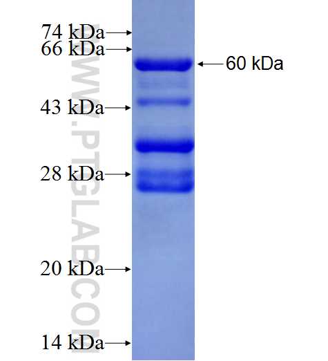 CARD14 fusion protein Ag0628 SDS-PAGE