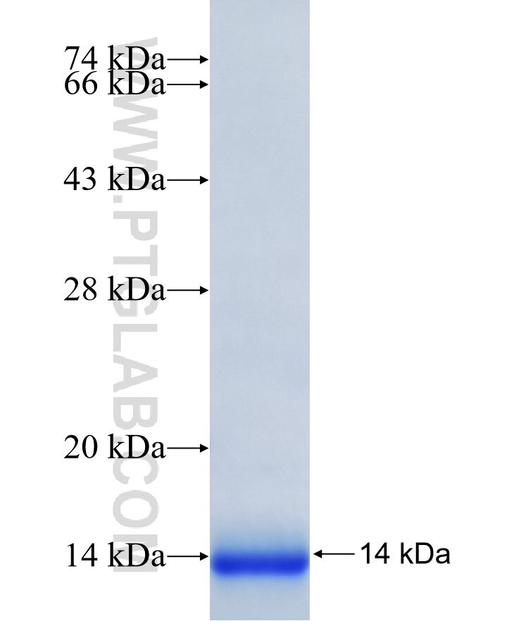CARD18 fusion protein Ag38249 SDS-PAGE CARD18 fusion protein Ag38249 SDS-PAGE