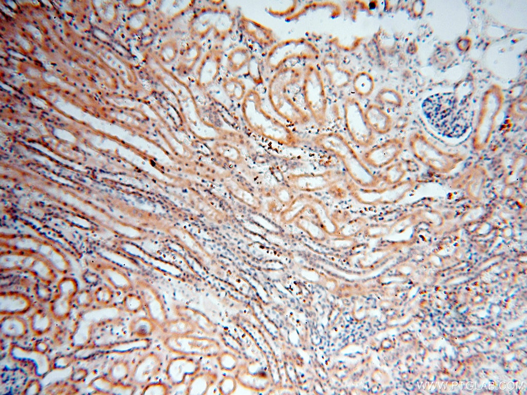 Immunohistochemistry (IHC) staining of human kidney tissue using CARD6 Polyclonal antibody (18029-1-AP)