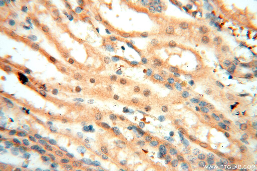 Immunohistochemistry (IHC) staining of human kidney tissue using CARD6 Polyclonal antibody (18029-1-AP)