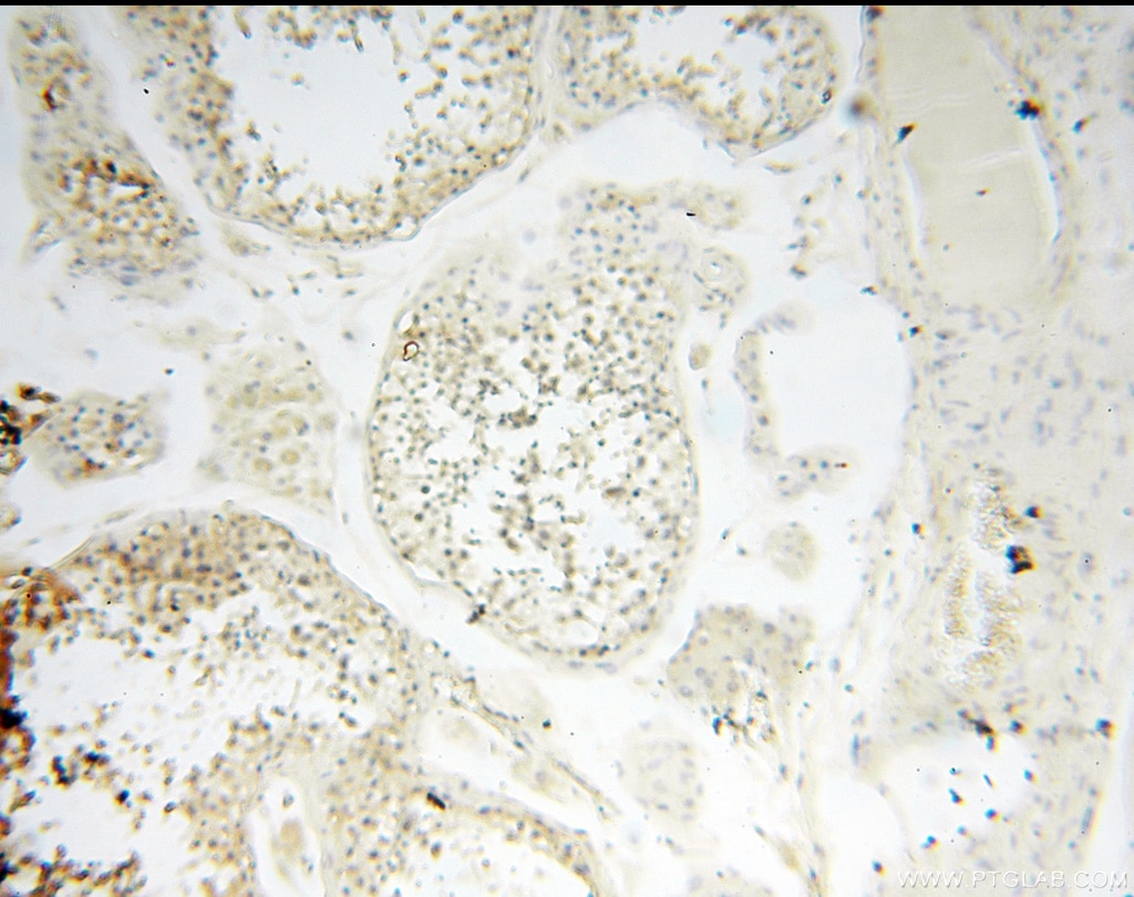 Immunohistochemistry (IHC) staining of human testis tissue using CARD6 Polyclonal antibody (18029-1-AP)