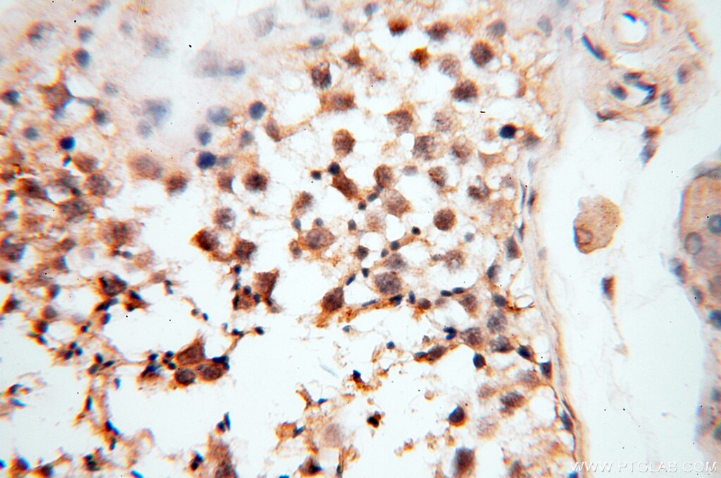 Immunohistochemistry (IHC) staining of human testis tissue using CARD6 Polyclonal antibody (18029-1-AP)