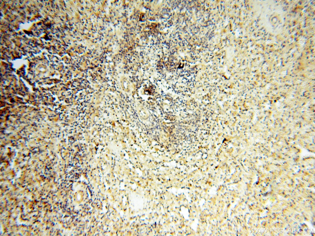 Immunohistochemistry (IHC) staining of human spleen tissue using CARD6 Polyclonal antibody (18029-1-AP)
